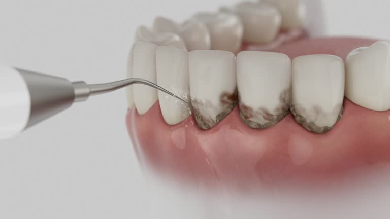 Trusted Teeth Cleaning And Checkup service in Thomasville, NC - Dentist Open Now